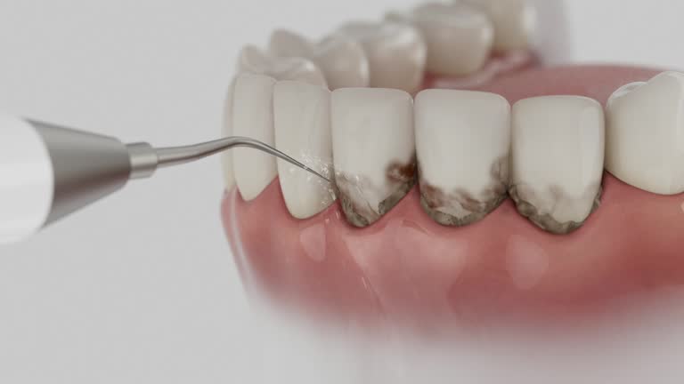 Reliable Dental contractor in Cottonwood, ID by Dentist Open Now
